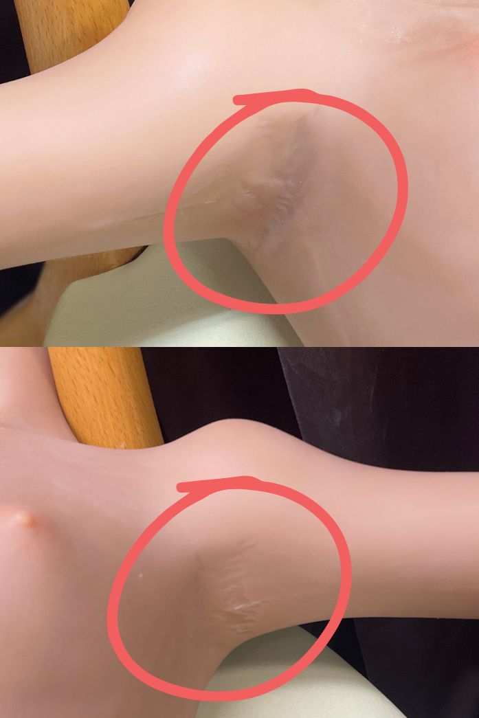 AXBDOLL 136cm A27 指の間の裂け